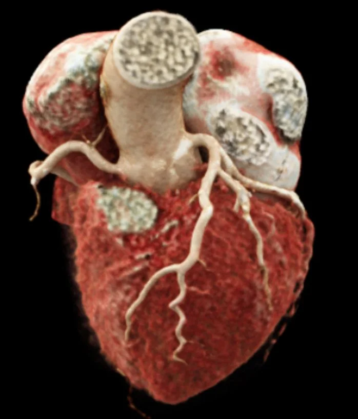 Cardiac CT scanner suite