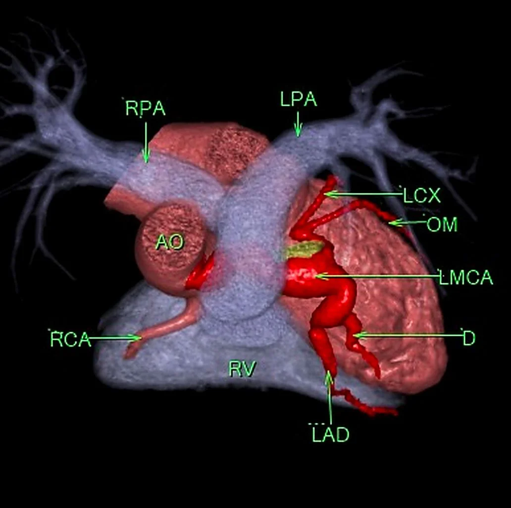 Advanced 3D cardiac reconstruction for surgical planning