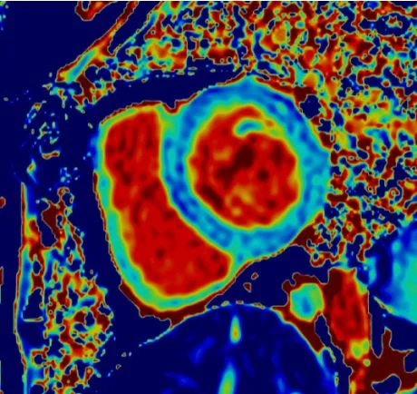Cardiac MRI acquisition and review